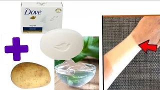 Homemade best permanent skin whitening soap using dove soap mixed with potato juice and aloevera gel