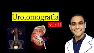 Curso de Tomografia c/contraste - Aula 11 (Urotomografia)