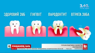 Якою має бути профілактика захворювання зубів та ясен – поради стоматолога