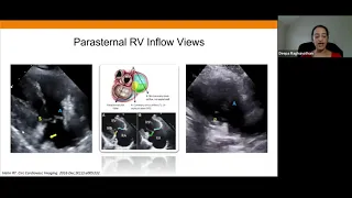 Joint Echo Conference: Structural Heart TV Intervention