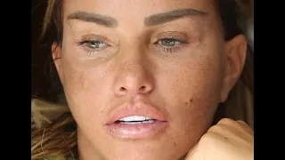 HORROR INJURIES Katie Price reveals bruised and battered face after man is arrested for attacking he