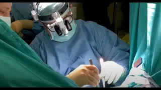 Имплантация мужского субуретрального слинга в Ильинской Больнице