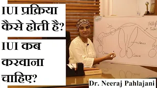 IUI प्रक्रिया कैसे की जाती है? IUI करवाना सबसे उत्तम? IUI Treatment Procedure Cost