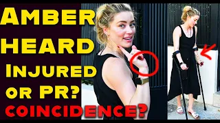 Amber Heard new pictures show her Injured like Johnny Deep, coincidence or PR?