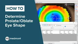 How-To | Determine Prolate vs Oblate eye shape