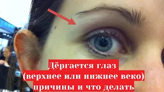 Почему дергается глаз 👁️​ (верхнее или нижнее веко)  причины и лечение