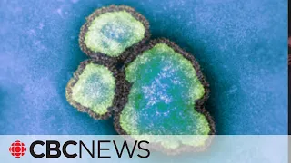 Child under 5 dies of measles, says Public Health Ontario