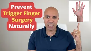 Prevent Trigger Finger Surgery! 3 Shocking *Secret* Natural Steps For Lasting Relief