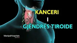 Kanceri i Gjëndrës Tiroide