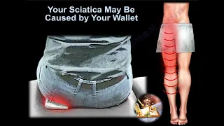 Your Sciatica May Be Caused By Your Wallet  - Everything You Need To Know - Dr. Nabil Ebraheim
