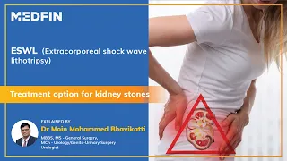 ESWL (Extracorporeal Shock Wave Lithotripsy) Surgery for Kidney stones explained