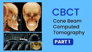 Read CBCT part 1 - Basics, Uses, Interpretations, Technical terms of Cone Beam CT Scan