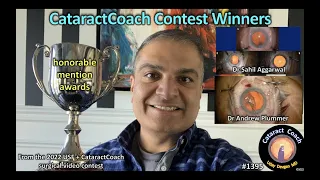 CataractCoach 1395: video contest winners: honorable mentions