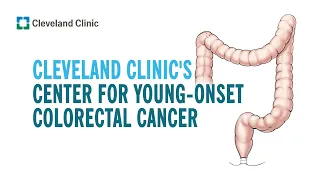 Cleveland Clinic's Center for Young-Onset Colorectal Cancer