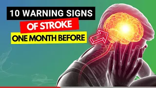 SHOCKING Warning Signs... Revealed! 10 Early Signs of Stroke