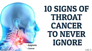 10 Signs of Throat Cancer to Never Ignore