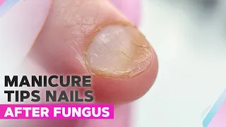 Manicure Tips | Nail Transformation | Fungus