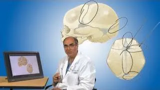 Plagiocephaly and its treatment | Boston Children’s Hospital