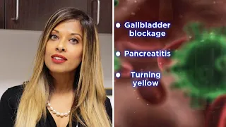 Can a DIY Gallbladder Flush Help Rid Gallstones?