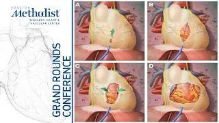 Diastolic Function (Miguel A. Quiñones, MD) February 24, 2022