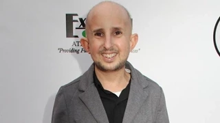 American Horror Story Actor in Critical Condition! Ben Woolf aka "Meep" Struck by Car in Hollywood