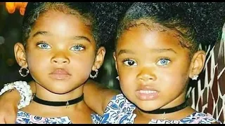 Милые близняшки покорили мир своей завораживающей красотой. Как они выглядят спустя 4 года