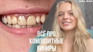 ВСЁ ПРО КОМПОЗИТНЫЕ ВИНИРЫ // БРУКСИЗМ