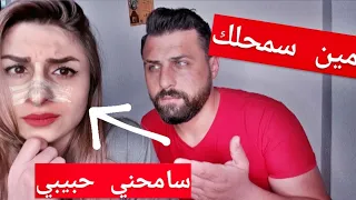 عملت عملية تجميل لأنفي بدون علم زوجي شوفو ردت فعلو ( مقلب من العيار الثقيل!! )