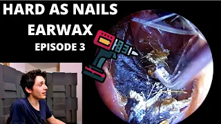 Hard As Nails Ear Wax EPISODE 3