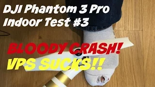 DJI Phantom 3 Professional Indoor Test #3 - Crash! Draws Blood! Drone Quadcopter - VPS SUCKS!