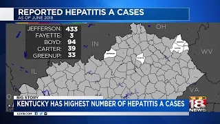 Kentucky Has Highest Number Of Hepatitis A Cases