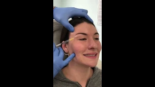 Dysport Injections for a Brow Lift with Dr. Sean Paul | Austin Oculofacial Plastics