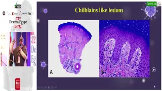 Egyptian Dermatopathology Academy Dr  Amira