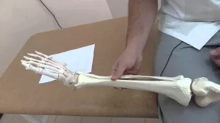 Боль и онемение в ноге при грыже диска.  Pain and numbness in the leg with disc herniation