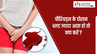 Heading: पीरियड्स में ज्यादा ब्लीडिंग क्यों होता है ? Heavy bleeding in periods | Dr Sushila Saini