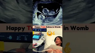 Emotional Twin Ultrasound Scan 🥰💯 #twin #ultrasound #pregnancy