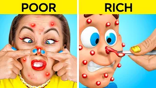 NEVER POP PIMPLES 😲 || Rich vs Poor DIY Fidget Toys | Cheap VS Expensive Gadgets by 123 GO!