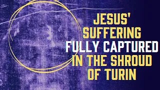 How is Jesus' suffering captured in the Shroud of Turin?