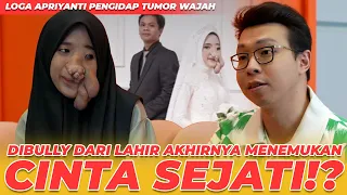 KISAH KASIH LOGA PEMILIK TUMOR WAJAH?! CINTA SEJATI!!