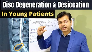 Disc Degeneration L5 S1, Disc Desiccation, Disc Degeneration Causes, DDD-Degenerative Disc Treatment