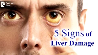 Liver disease Symptoms in adults. 5 Signs your liver is damaged - Dr. Ravindra B S | Doctors' Circle