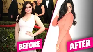 Celebrities Who Have Had Breast Reduction Surgery