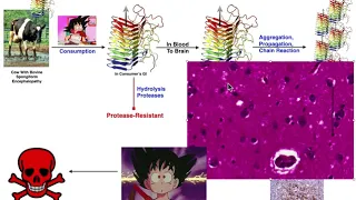 Prions | Mad Cow Disease & Variant Creutzfeldt-Jakob Disease (vCJD)