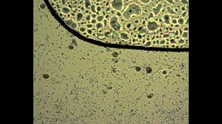Инфузория туфелька, коловратка, бактерии под микроскопом Микромед 1