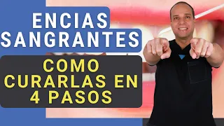 ENCIAS INFLAMADAS y SANGRANTES 😳 Como CURARLAS en 4 PASOS [Funciona] 😃✌