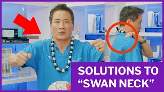 BOTOX for "SWAN NECK" | Trapezius Botox | Dr. David Yew