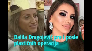 Dalila Dragojević pre i posle plastičnih operacija