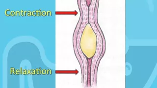 Swallowing Disorders and Achalasia