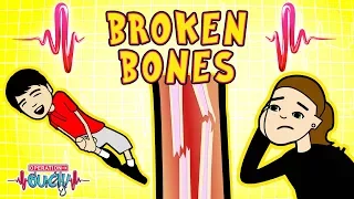 Science for kids | Body Parts - BROKEN BONES | Experiments for kids | Operation Ouch