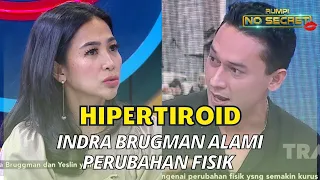 Hadapi Penyakit Hipertiroid, Indra Brugman Alami Perubahan Fisik | RUMPI (28/10/22) P1